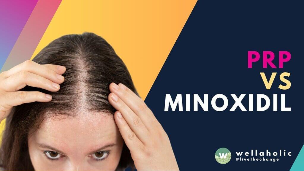 Compare PRP vs Minoxidil hair treatments in Singapore. Discover which solution delivers better results for hair growth with expert insights from Wellaholic. Book consultation today.