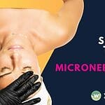 Best serums after microneedling in Singapore: hyaluronic acid, peptides, ceramides for healing. Expert aftercare guide from Wellaholic's certified therapists.