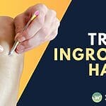 Say goodbye to ingrown hairs with laser hair removal in Singapore! Achieve smooth, hair-free skin with this long-lasting solution that's perfect for all skin types.