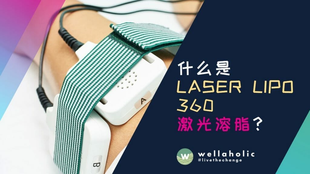 什么是Laser Lipo 360激光溶脂？