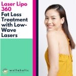 Laser Lipo 360 By Wellaholic