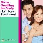 Microneedling for Scalp Treatment