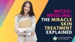 MICRONEEDLING: THE MIRACLE SKIN TREATMENT EXPLAINED