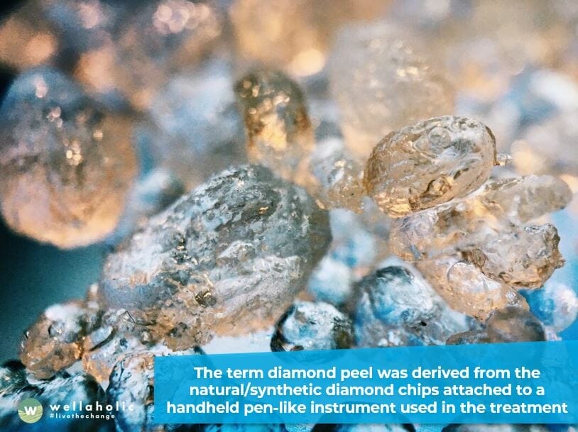How did Diamond Peel come about?
