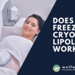 Unlock the power of cold with WellaFreeze and Cryolipolysis. Discover 5 key facts about these innovative weight loss methods and their effectiveness.