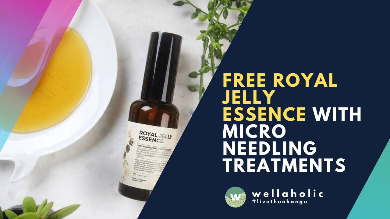 free royal jelly essence microneedling