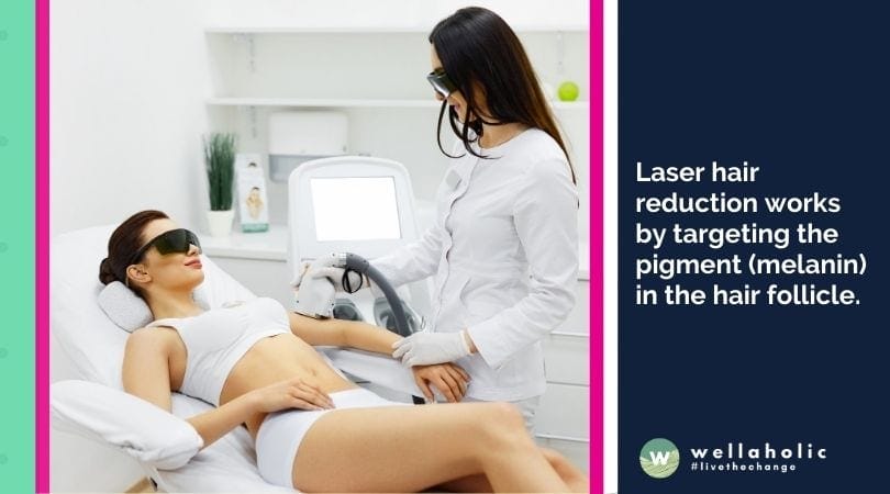 Laser hair reduction works by targeting the pigment (melanin) in the hair follicle. Melanin after that absorbs the warm supplied by the laser and also transfers it to the neighbouring growth nerve centre of the hair follicle (stem cells).