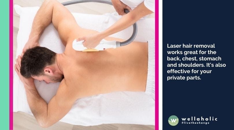 laser hair removal is great for large body areas such as chest, back, etc. 