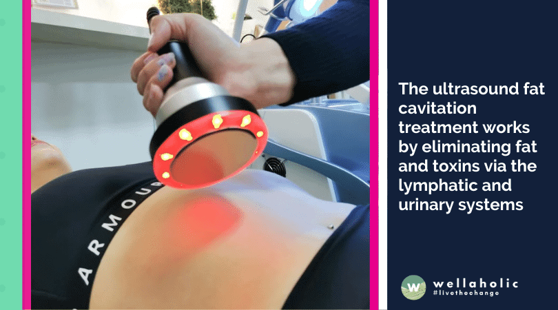 The ultrasound fat cavitation treatment works by eliminating fat and toxins via the lymphatic and urinary systems