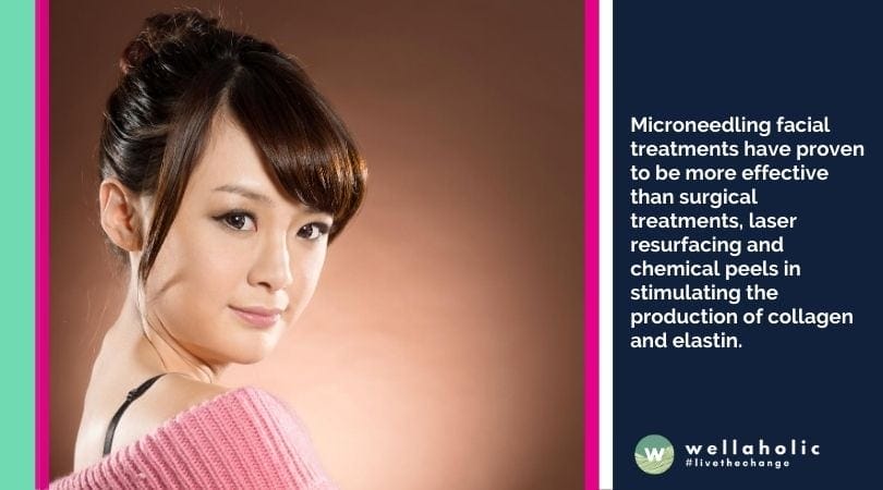 Safety Guidelines for Microneedling