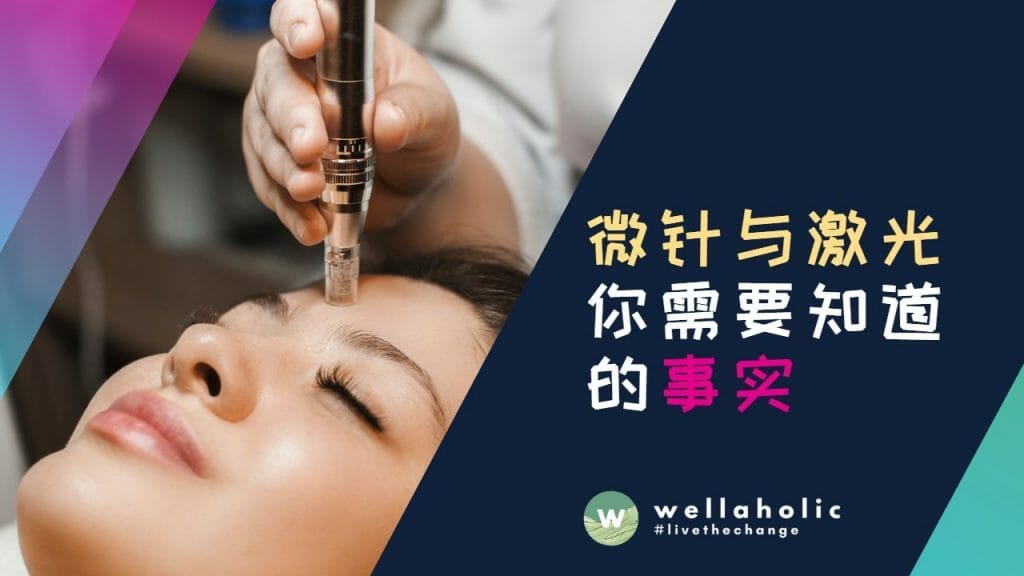 微针与激光 - 你需要知道的