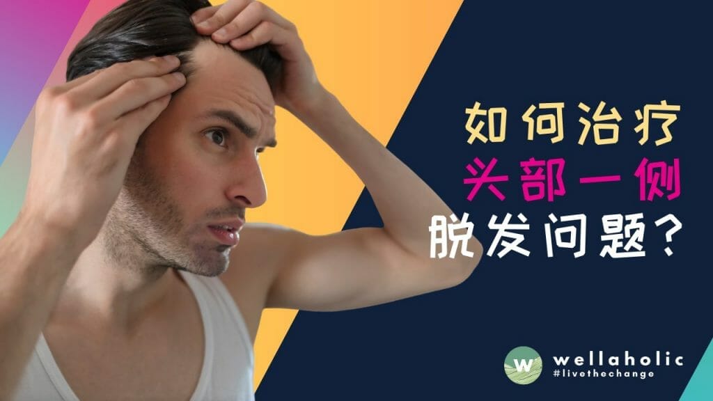 如何治疗头部一侧脱发问题？了解原因与有效治疗方法。