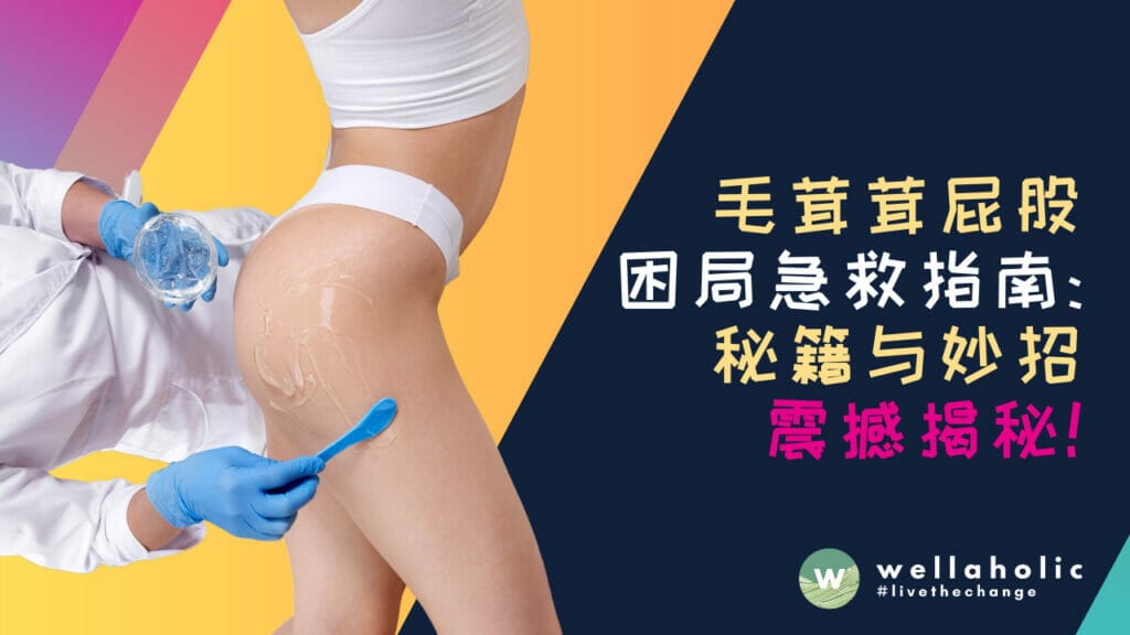 新加坡毛茸茸屁股困局急救指南：秘籍与妙招震撼揭秘！