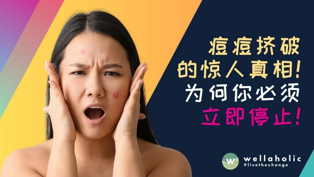 痘痘挤破的惊人真相！为何你必须立即停止，否则后果不堪设想！